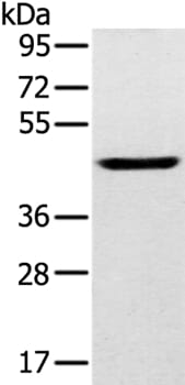 Gel: 8% SDS-PAGE Lysates (from left to right): Human fetal brain tissue Amount of lysate: 40ug per lane Primary antibody: 1/200 dilution Secondary antibody dilution: 1/8000 Exposure time: 2 minutes