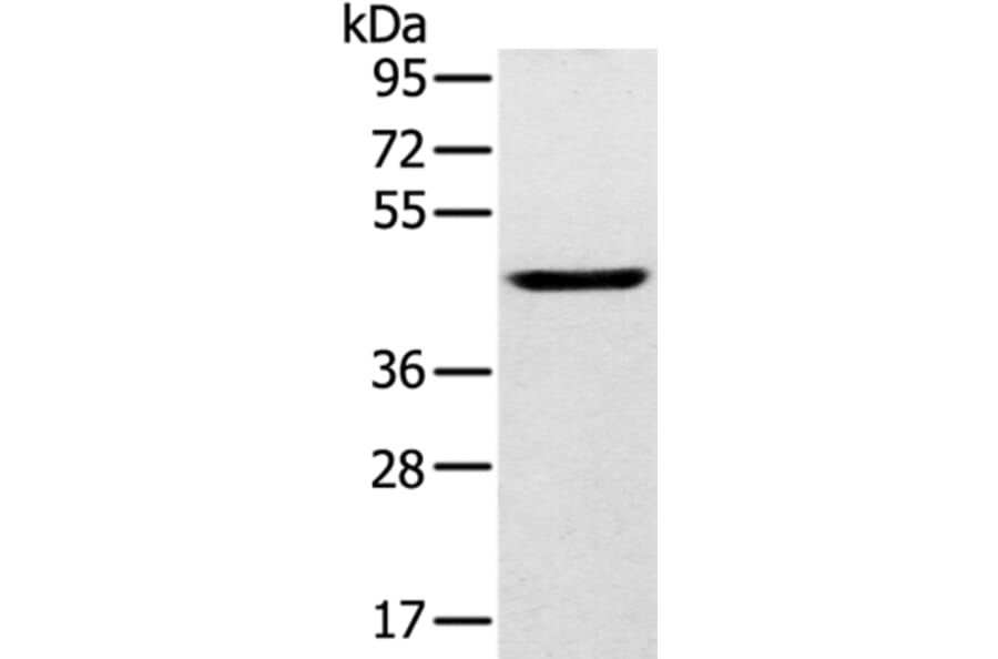 SLC16A8 Antibody from Signalway Antibody (37929) - Antibodies.com