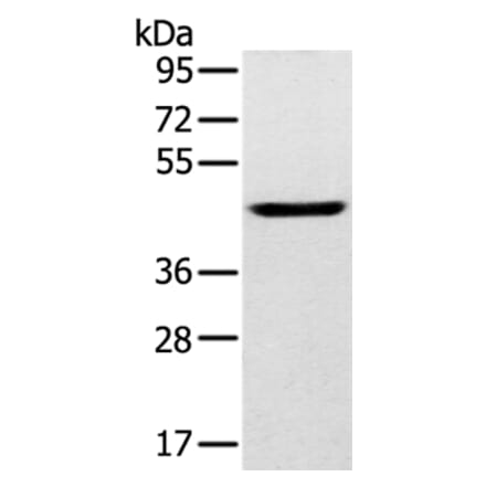 SLC16A8 Antibody from Signalway Antibody (37929) - Antibodies.com