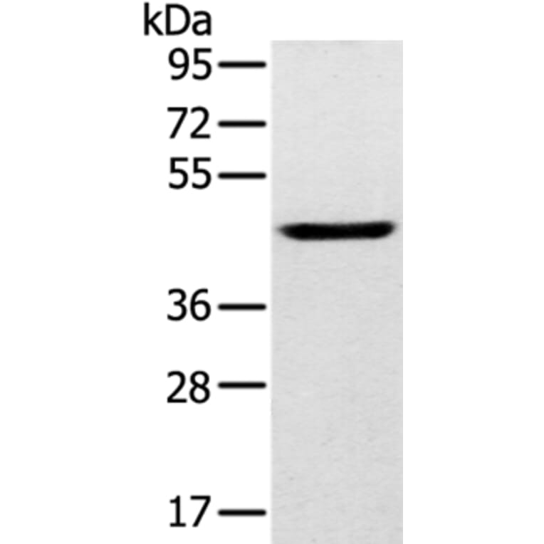SLC16A8 Antibody from Signalway Antibody (37929) - Antibodies.com