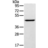 SLC16A8 Antibody from Signalway Antibody (37929) - Antibodies.com