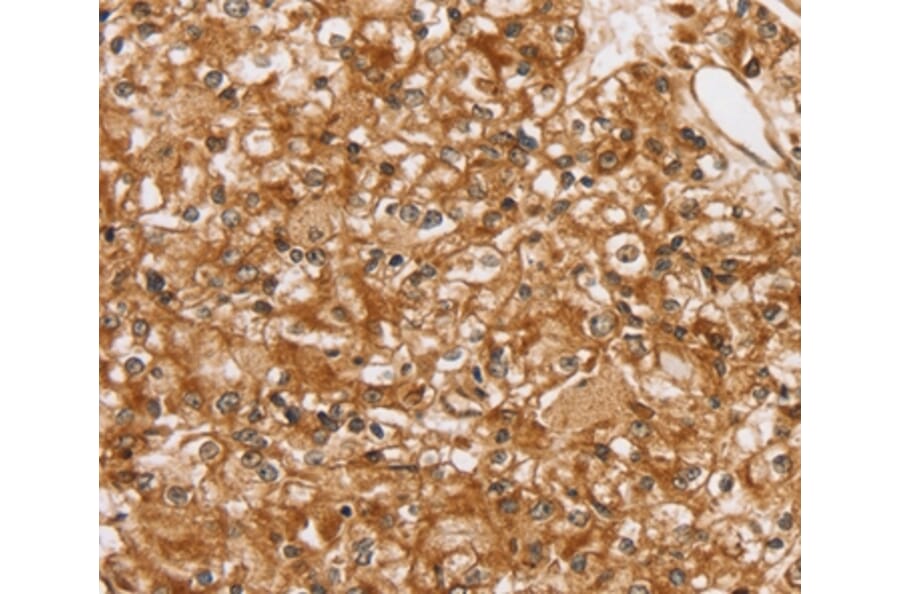 Immunohistochemistry - SLC16A8 Antibody from Signalway Antibody (37929) - Antibodies.com