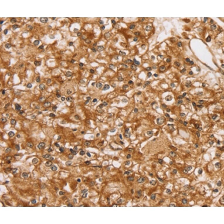 Immunohistochemistry - SLC16A8 Antibody from Signalway Antibody (37929) - Antibodies.com
