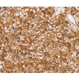 Immunohistochemistry - SLC16A8 Antibody from Signalway Antibody (37929) - Antibodies.com