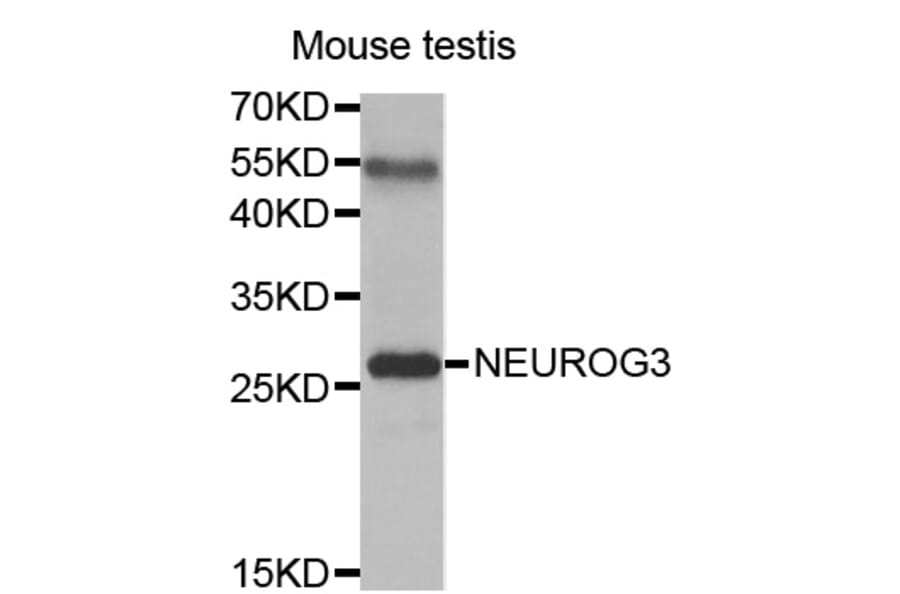 Western blot - NEUROG3 antibody from Signalway Antibody (38461) - Antibodies.com