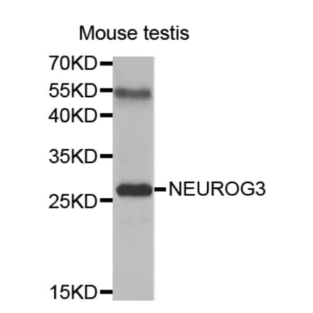 Western blot - NEUROG3 antibody from Signalway Antibody (38461) - Antibodies.com