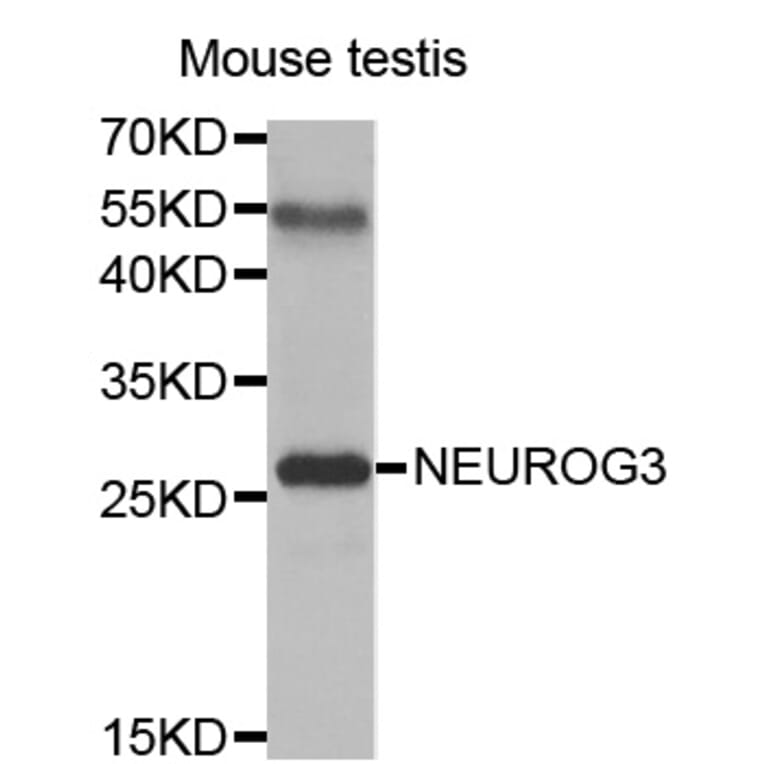 Western blot - NEUROG3 antibody from Signalway Antibody (38461) - Antibodies.com