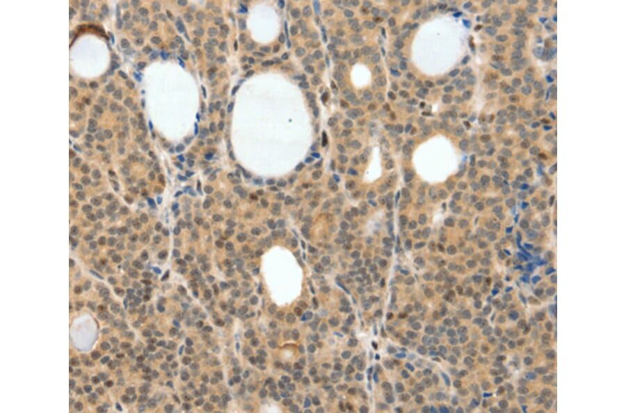 Immunohistochemistry - NEUROG3 antibody from Signalway Antibody (38461) - Antibodies.com