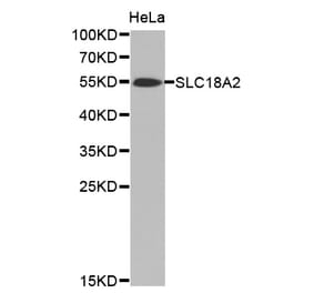 Western blot - SLC18A2 antibody from Signalway Antibody (38471) - Antibodies.com