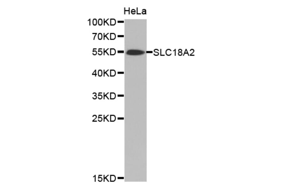 Western blot - SLC18A2 antibody from Signalway Antibody (38471) - Antibodies.com