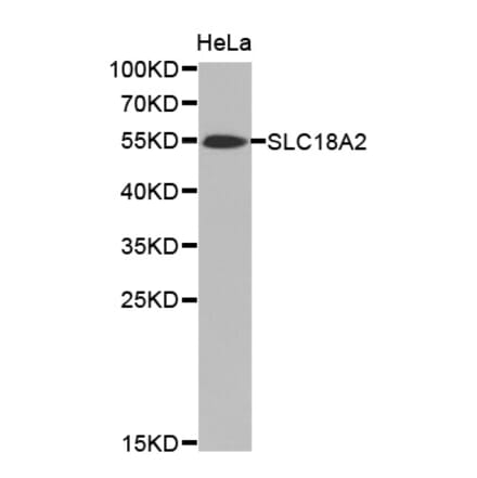 Western blot - SLC18A2 antibody from Signalway Antibody (38471) - Antibodies.com