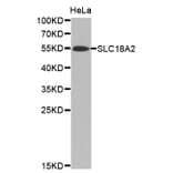 Western blot - SLC18A2 antibody from Signalway Antibody (38471) - Antibodies.com