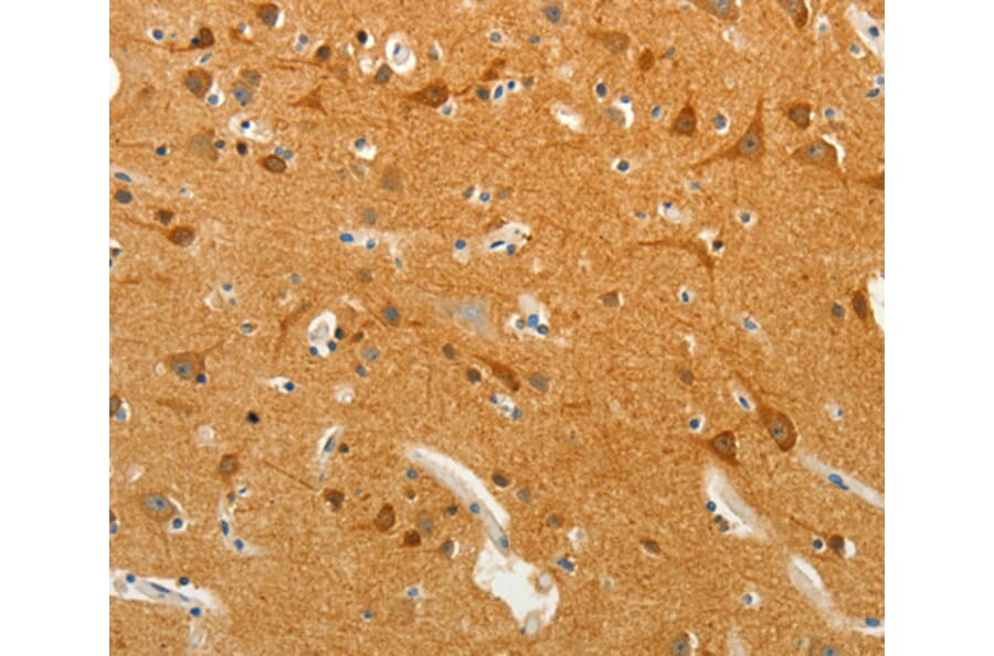 Immunohistochemistry - SLC18A2 antibody from Signalway Antibody (38471) - Antibodies.com