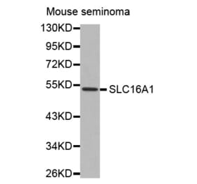 Western blot - SLC16A1 antibody from Signalway Antibody (38537) - Antibodies.com