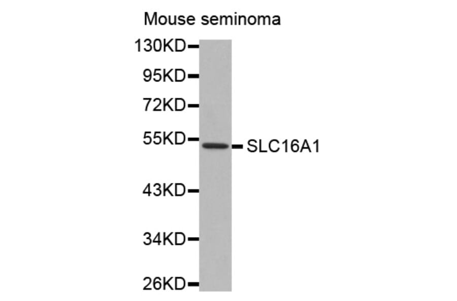 Western blot - SLC16A1 antibody from Signalway Antibody (38537) - Antibodies.com