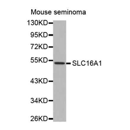 Western blot - SLC16A1 antibody from Signalway Antibody (38537) - Antibodies.com