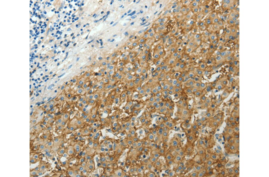 Immunohistochemistry - SLC16A1 antibody from Signalway Antibody (38537) - Antibodies.com