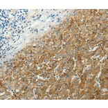 Immunohistochemistry - SLC16A1 antibody from Signalway Antibody (38537) - Antibodies.com