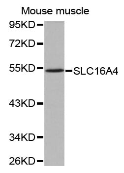 Western blot analysis of extracts of mouse muscle tissue lysate, using SLC16A4 antibody.