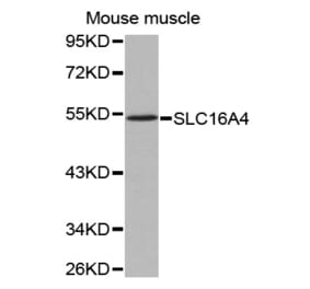 Western blot - SLC16A4 antibody from Signalway Antibody (38538) - Antibodies.com