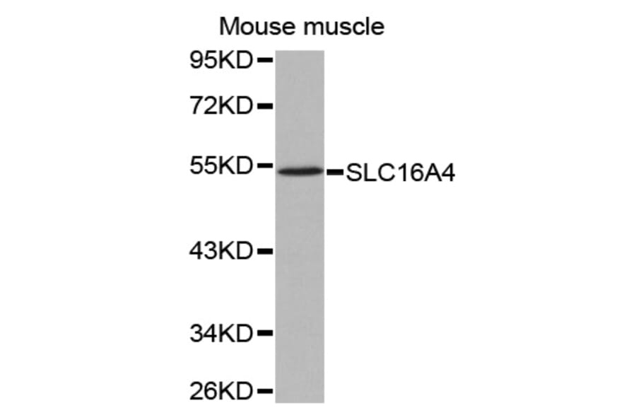 Western blot - SLC16A4 antibody from Signalway Antibody (38538) - Antibodies.com