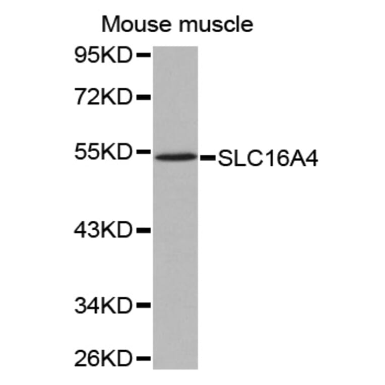 Western blot - SLC16A4 antibody from Signalway Antibody (38538) - Antibodies.com