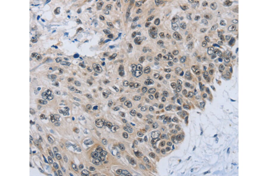 Immunohistochemistry - SLC16A4 antibody from Signalway Antibody (38538) - Antibodies.com