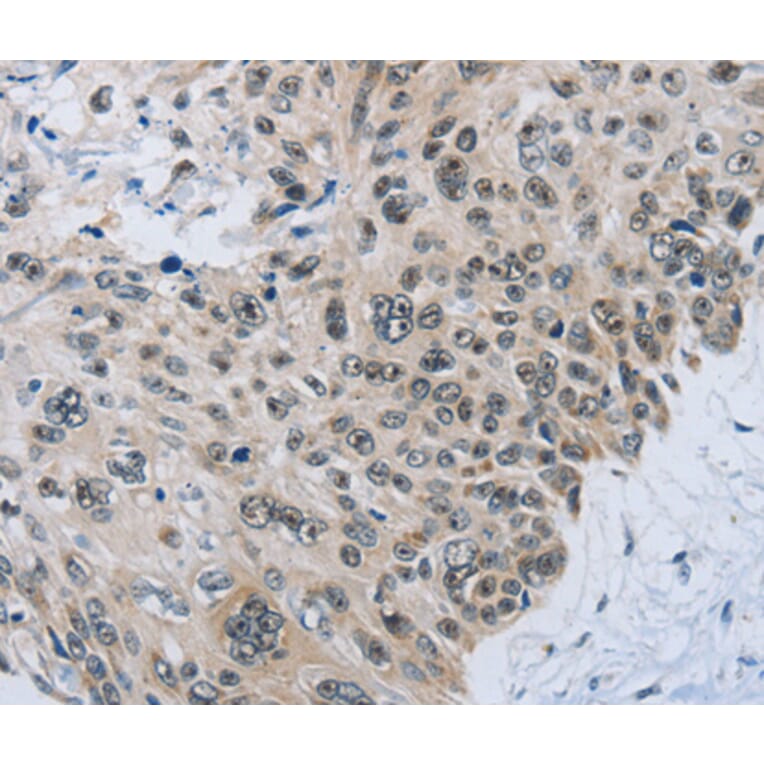 Immunohistochemistry - SLC16A4 antibody from Signalway Antibody (38538) - Antibodies.com