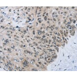 Immunohistochemistry - SLC16A4 antibody from Signalway Antibody (38538) - Antibodies.com