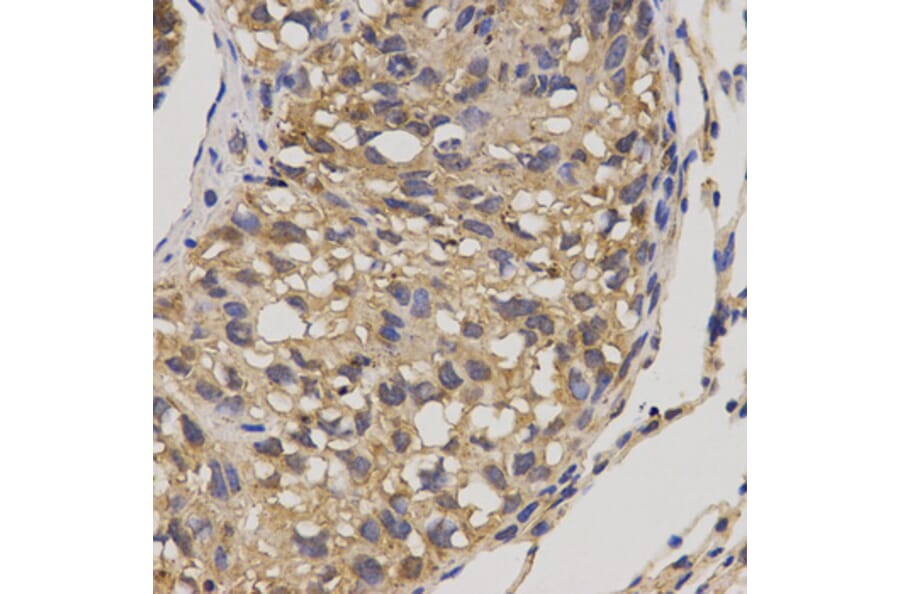 Immunohistochemistry - SLC16A4 antibody from Signalway Antibody (38538) - Antibodies.com