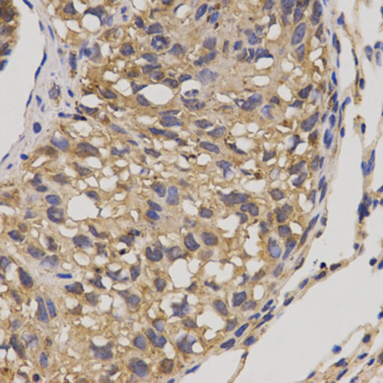 Immunohistochemistry - SLC16A4 antibody from Signalway Antibody (38538) - Antibodies.com