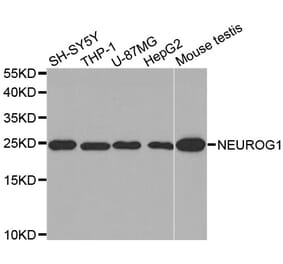 Western blot - NEUROG1 antibody from Signalway Antibody (38585) - Antibodies.com