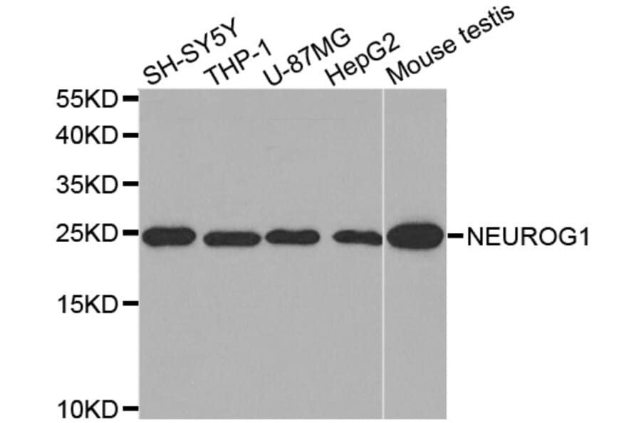 Western blot - NEUROG1 antibody from Signalway Antibody (38585) - Antibodies.com