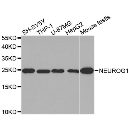 Western blot - NEUROG1 antibody from Signalway Antibody (38585) - Antibodies.com