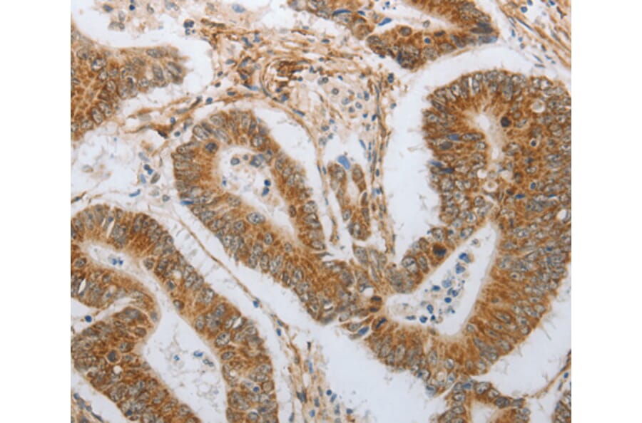 Immunohistochemistry - NEUROG1 antibody from Signalway Antibody (38585) - Antibodies.com