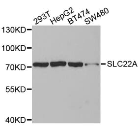 Western blot - SLC22A8 antibody from Signalway Antibody (38590) - Antibodies.com