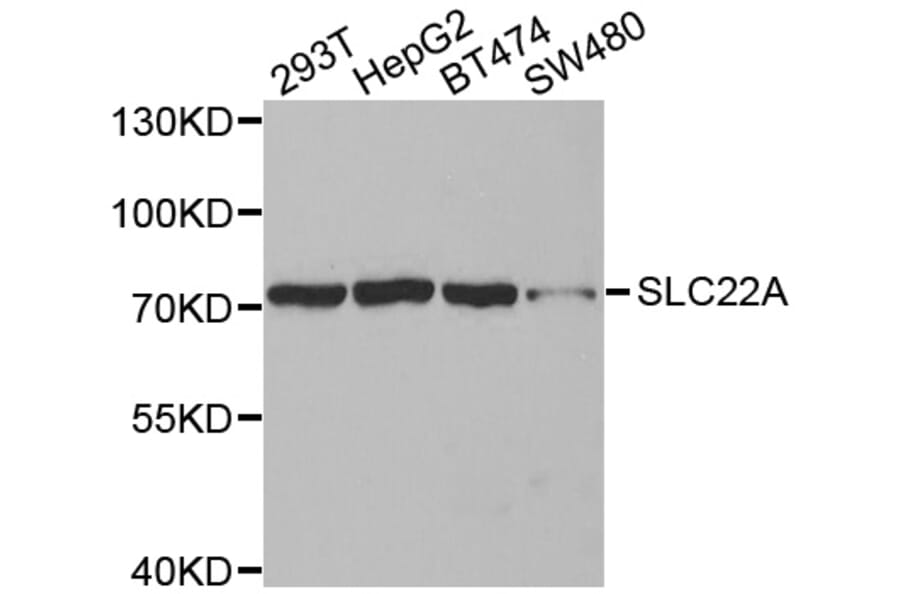 Western blot - SLC22A8 antibody from Signalway Antibody (38590) - Antibodies.com