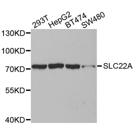 Western blot - SLC22A8 antibody from Signalway Antibody (38590) - Antibodies.com