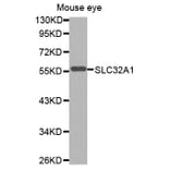 Western blot - SLC32A1 antibody from Signalway Antibody (38597) - Antibodies.com