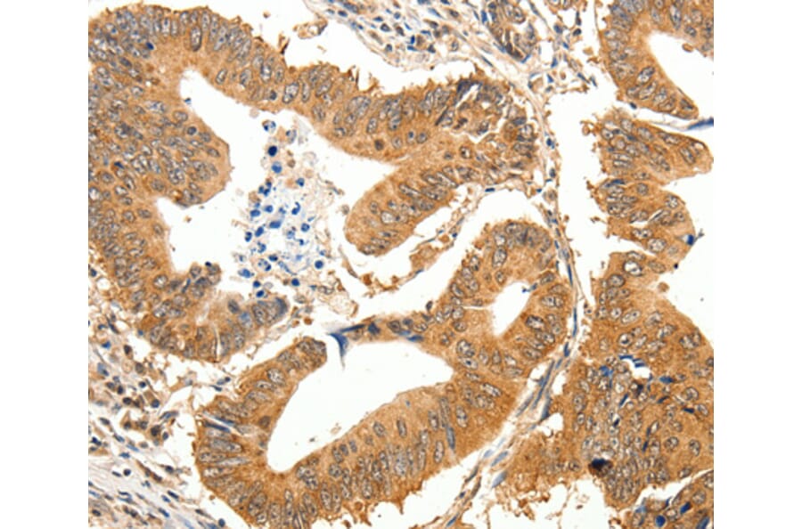 Immunohistochemistry - SLC32A1 antibody from Signalway Antibody (38597) - Antibodies.com