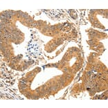 Immunohistochemistry - SLC32A1 antibody from Signalway Antibody (38597) - Antibodies.com