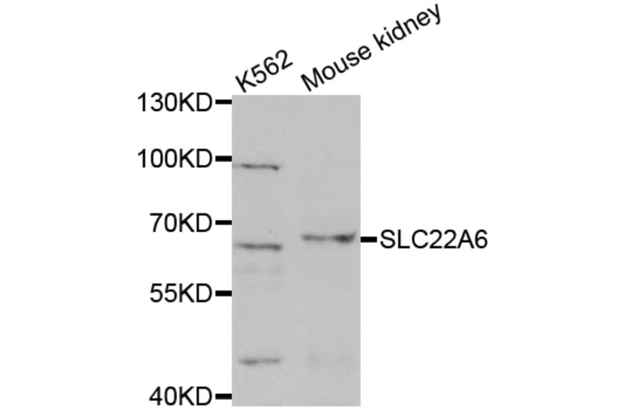 Western blot - SLC22A6 antibody from Signalway Antibody (38623) - Antibodies.com