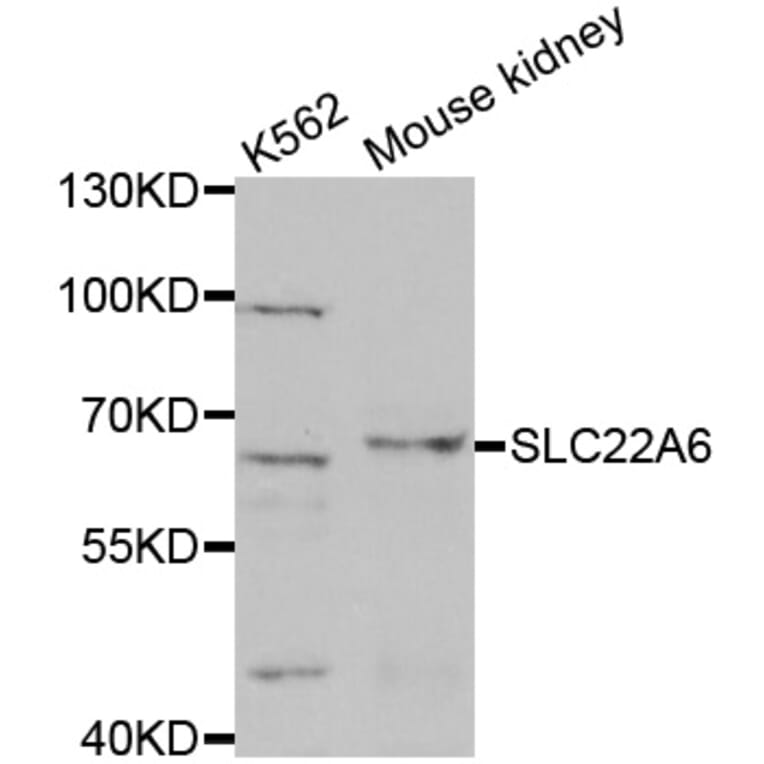 Western blot - SLC22A6 antibody from Signalway Antibody (38623) - Antibodies.com