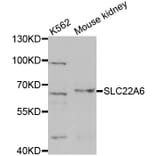 Western blot - SLC22A6 antibody from Signalway Antibody (38623) - Antibodies.com