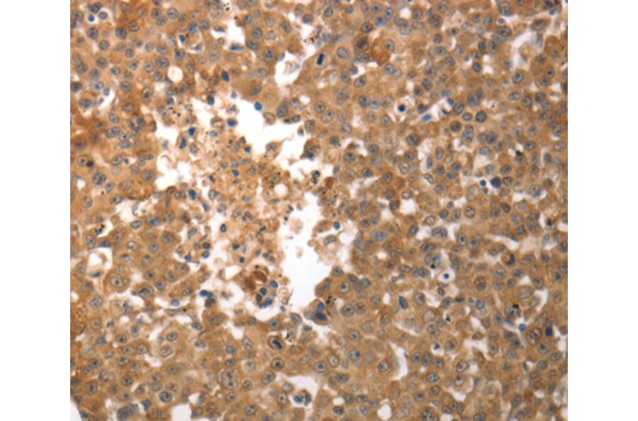 Immunohistochemistry - SLC22A6 antibody from Signalway Antibody (38623) - Antibodies.com