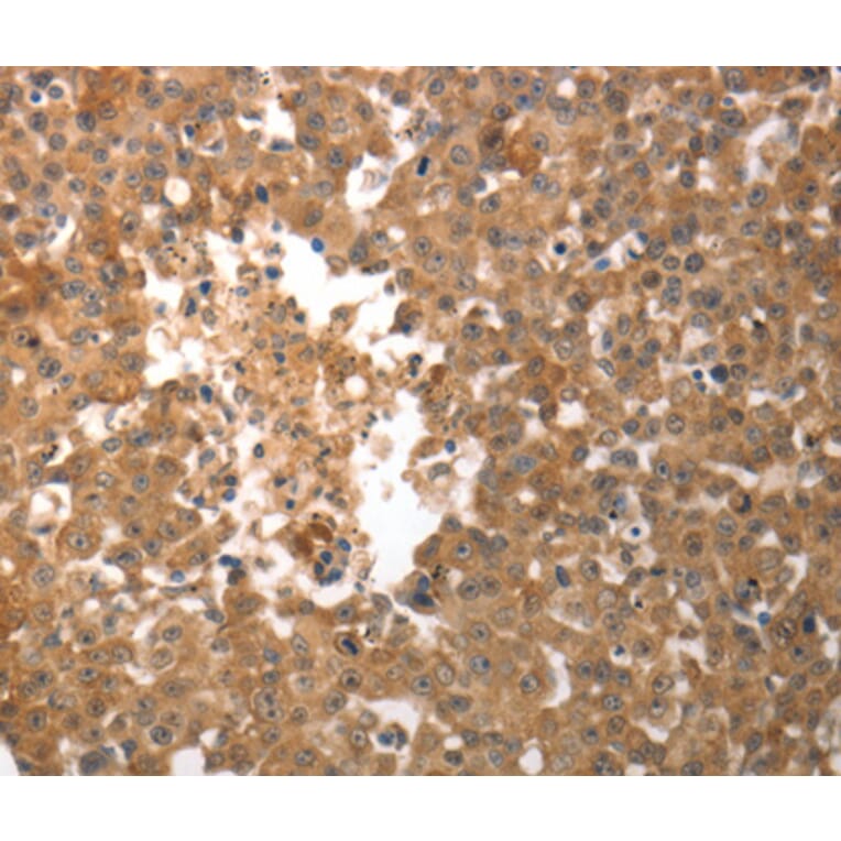 Immunohistochemistry - SLC22A6 antibody from Signalway Antibody (38623) - Antibodies.com