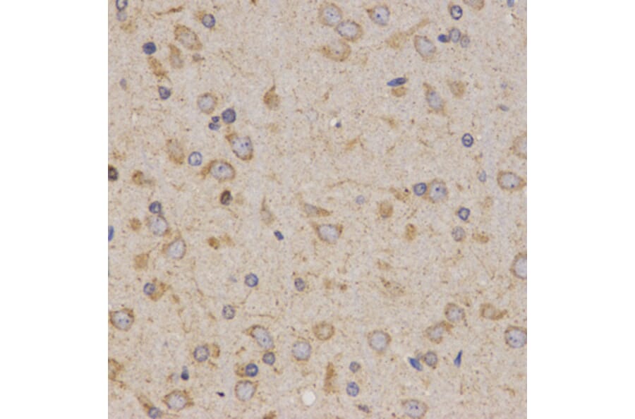 Immunohistochemistry - Eif2ak2 antibody from Signalway Antibody (38673) - Antibodies.com