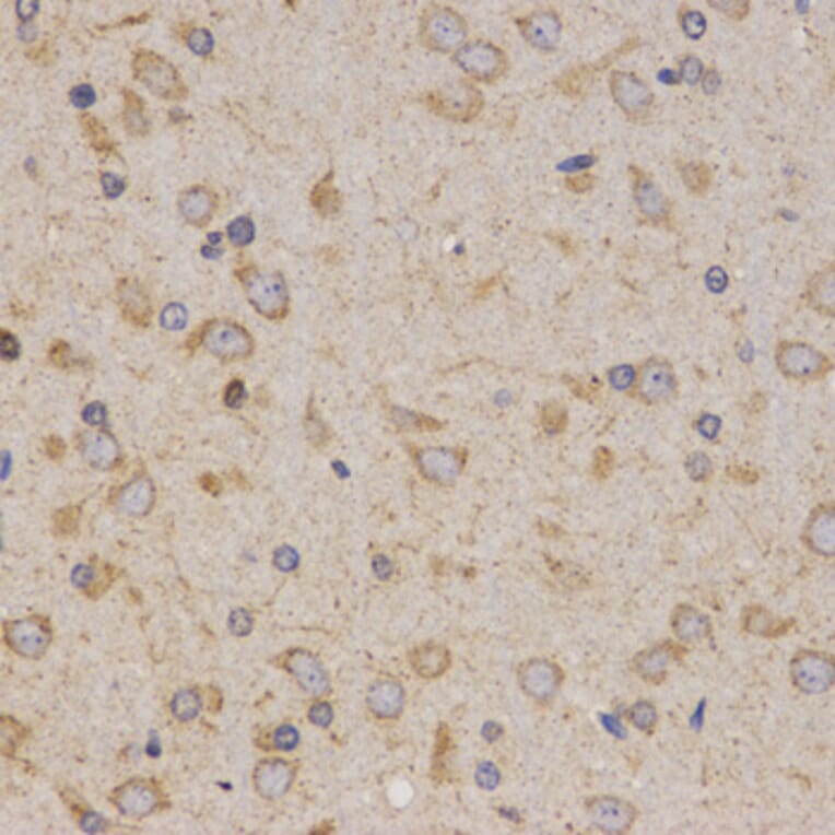 Immunohistochemistry - Eif2ak2 antibody from Signalway Antibody (38673) - Antibodies.com