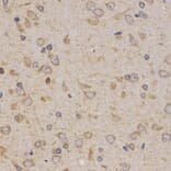 Immunohistochemistry - Eif2ak2 antibody from Signalway Antibody (38673) - Antibodies.com