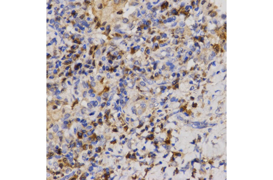 Immunohistochemistry - Eif2ak2 antibody from Signalway Antibody (38673) - Antibodies.com